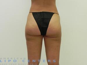 americanlipocenters_157.jpg